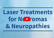 Laser Treatments for Neuromas and Neuropathies